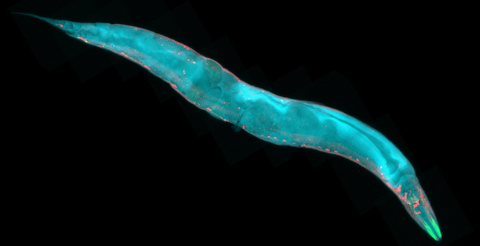 Caenorhabditis elegans, a free-living transparent nematode (roundworm), about 1 mm in length. Fluorescence micrograph.