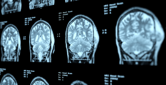 Vanderbilt University