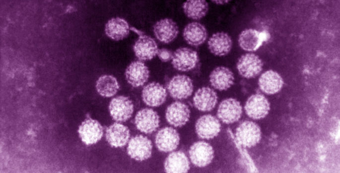 Vanderbilt University