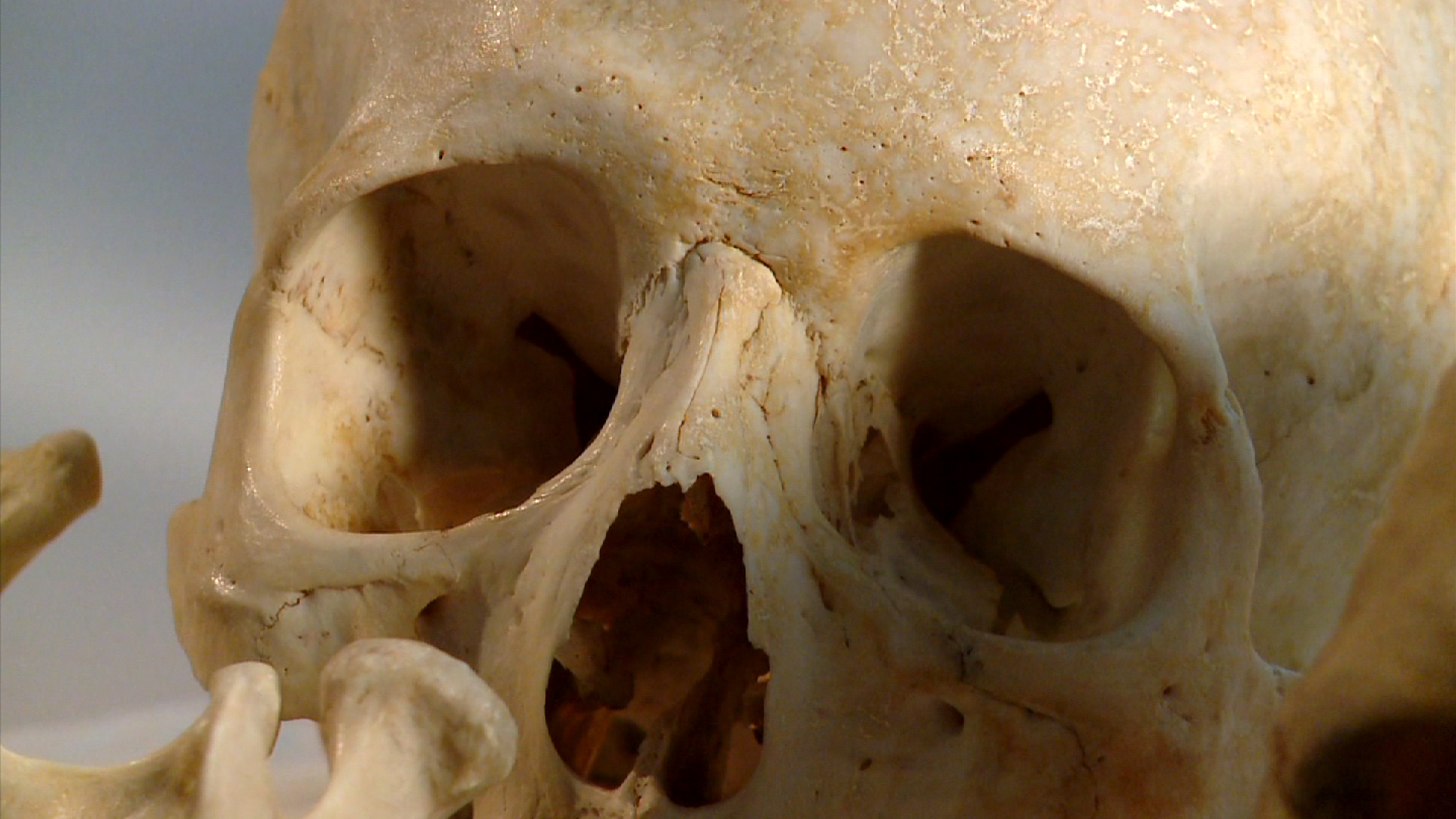 Vanderbilt University