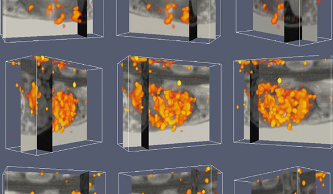 Vanderbilt University