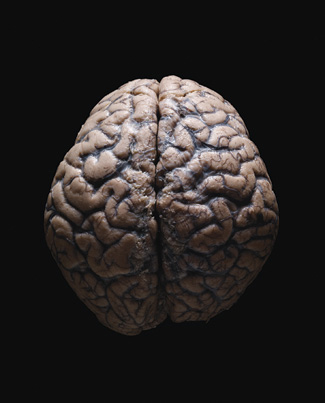 Image of brain