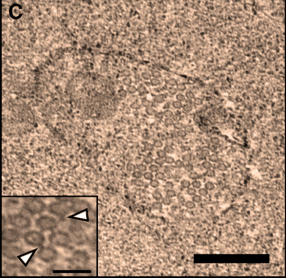 The oval shape in this electron microphotograph is a Wolbachia bacterium that has infected a Nasonia wasp. The small dots in the bacterium are WO phage particles. The inset shows them at a higher magnification. The white arrows in the inset point to the phage tails. The scale bar in the image is 200 nm and the bar in he inset is 100 nm. (Bordenstein Lab / Vanderbilt)