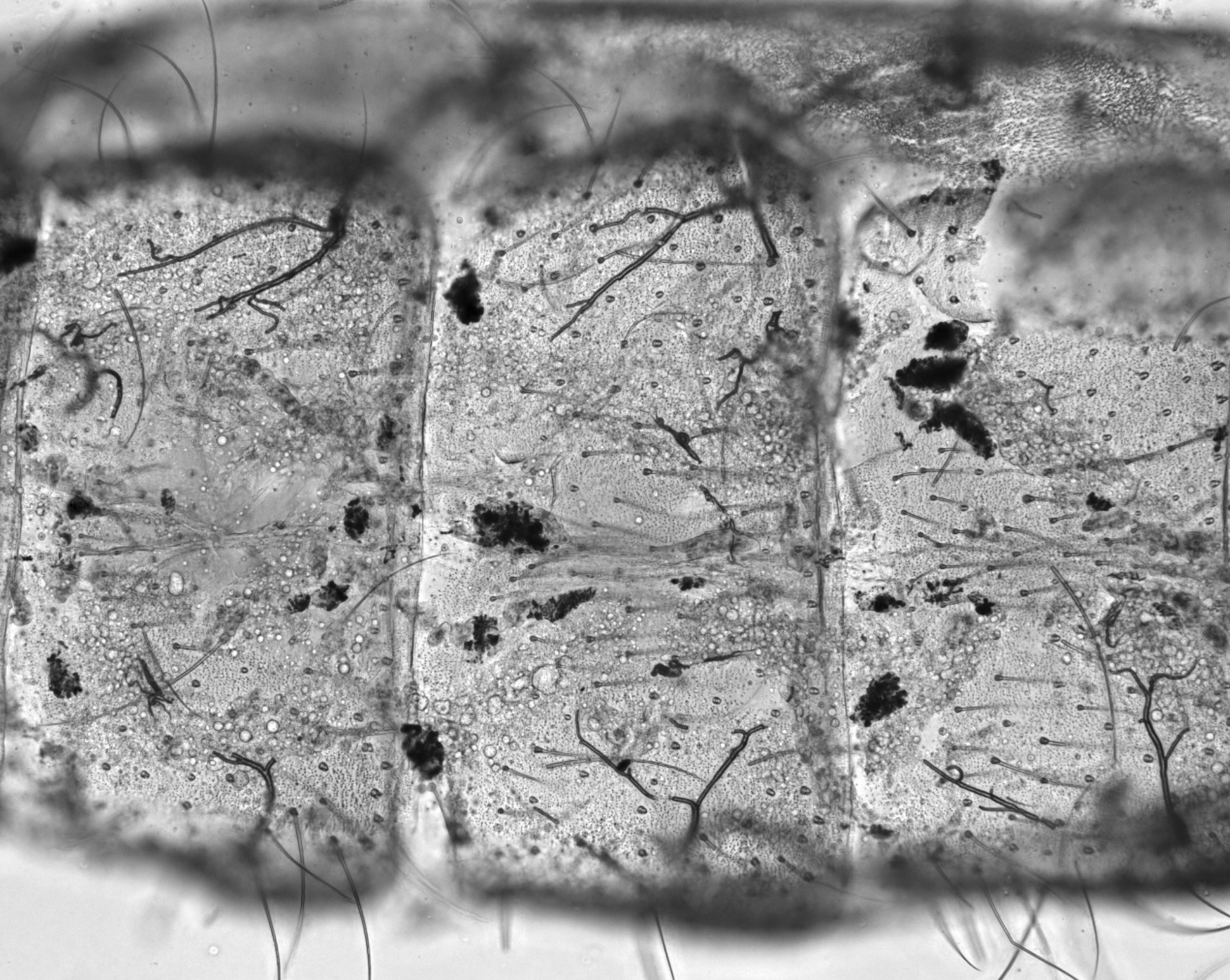 Picture of mosquito abdomen taken using microscope with melanization immune response visible.