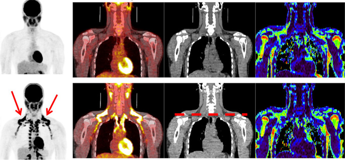 Vanderbilt University
