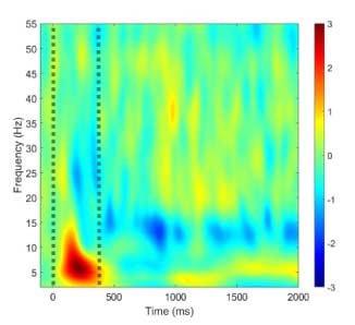 Disease mechanisms of Tourette syndrome