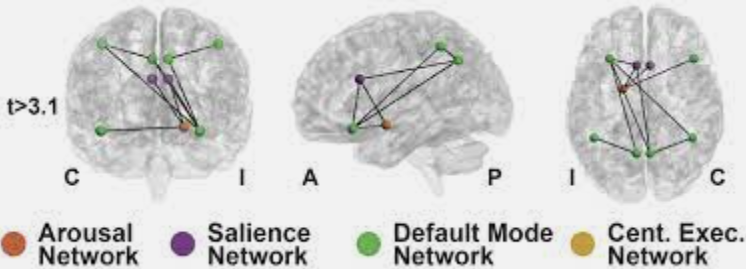 Vanderbilt University