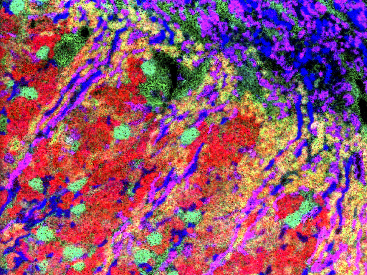 Vanderbilt University