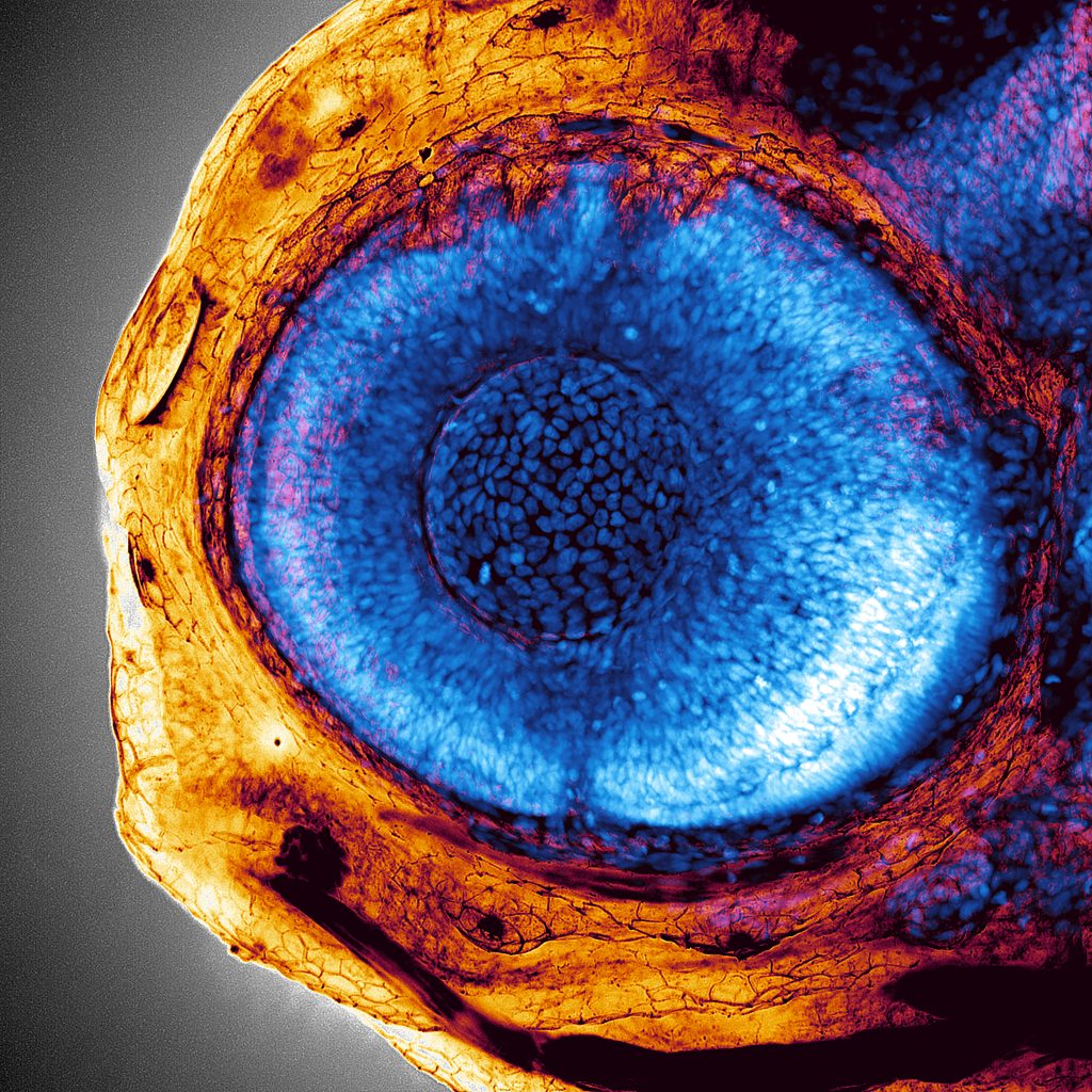 Fluorescence microscopy image of a zebrafish head and eye. The head is mostly imaged in orange and the eye, strikingly, is imaged in blue. Individual blue cells are discernible in the eye.