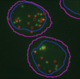 Fluorescence microscopy image of two cells (outlined in magenta) and their nuclei (outlined in dark blue). Several green spots are visible throughout, and most are encircled in red.