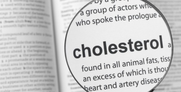 Cholesterol