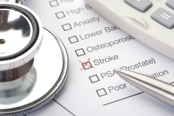 Close up of stroke checked on a medical test