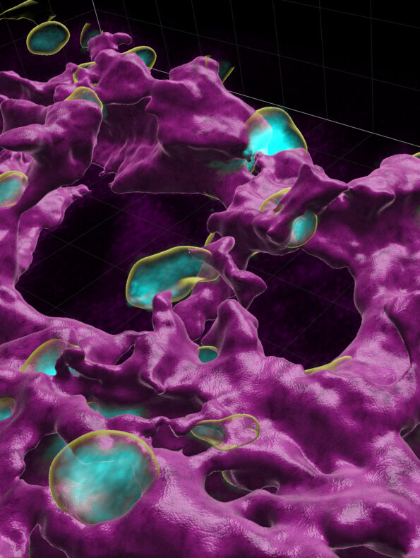 Alveolar epithelial cells (cyan) bud from mesenchymal rings of myofibroblasts and other cells (magenta). 