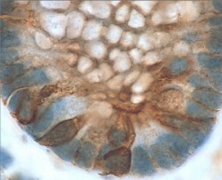 colitis_Rosen-300 Colitis