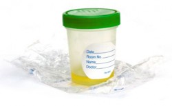 urine sample