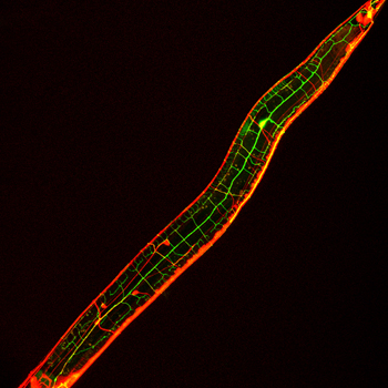 C elegans neuron branching