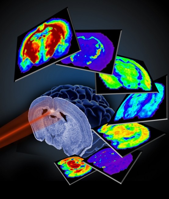 caprioli-figure-large Imaging mass spectometry image