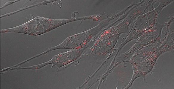 Neurons with serotonin transporters labeled with quantum dots. (Jerry Chang / Vanderbilt)