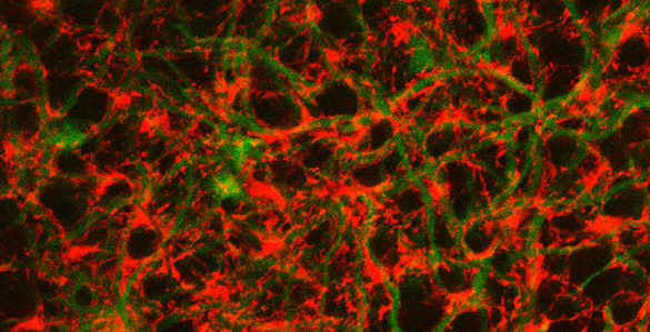 colored representation of cells and glia