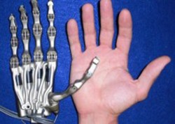 Bionic_hand_VISE