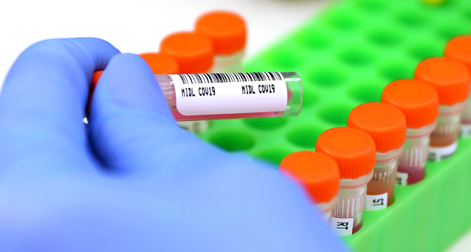 Pending COVID-19 samples are prepared for testing in the Diagnostic Laboratories at VUMC.