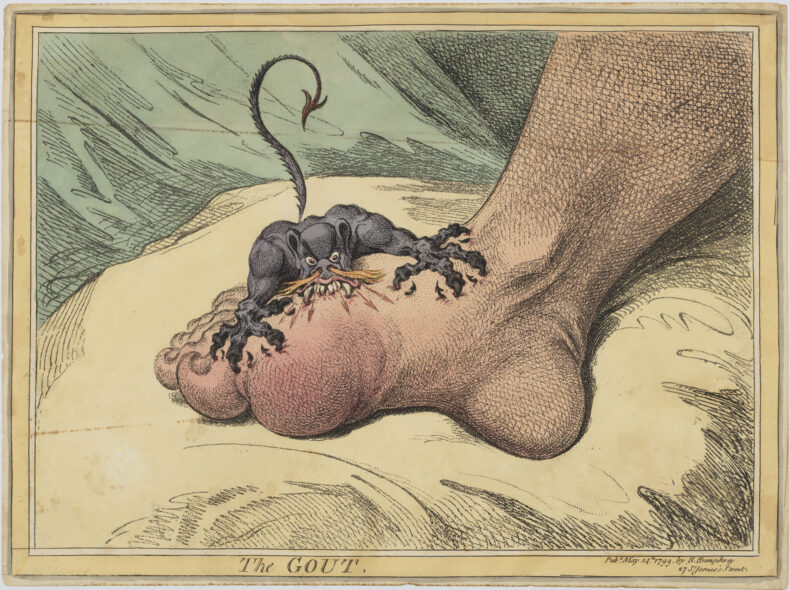 “The Gout” by British artist James Gillray is a hand-colored soft-ground etching from 1799 and is in the collection of the Metropolitan Museum of Art. (public domain)