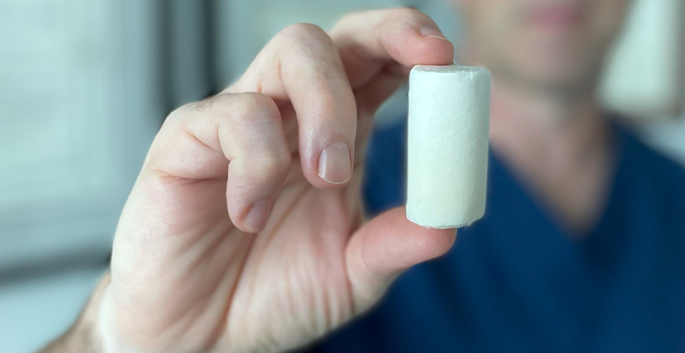 In the bridge-enhanced ACL restoration process, a sponge-like implant creates an environment in which torn ACL fibers can heal.