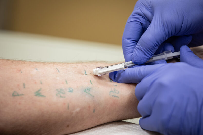 Vanderbilt’s Drug Allergy Clinic has been sought out by patients across the country as a center of excellence for patients with rare drug allergies that can be fatal. (photo by Erin O. Smith)