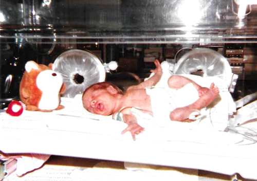 Walker was the smallest of triplets. She spent six weeks in the hospital as a newborn.