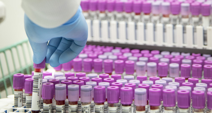 VUMC’s new automated biobanking system can store as many as 10 million biospecimens.