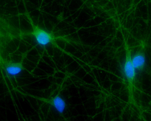Microscopy image showing human neurons in blue (indicating cell nuclei) and green (indicating mutated protein)
