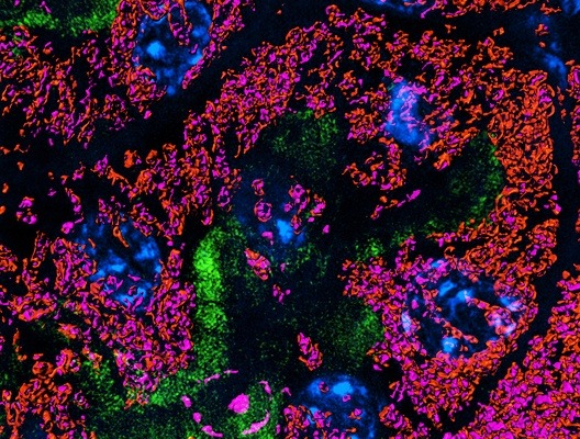 Mitochondria renal epithelium