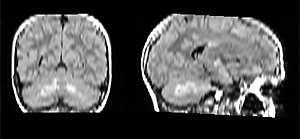 Vanderbilt University