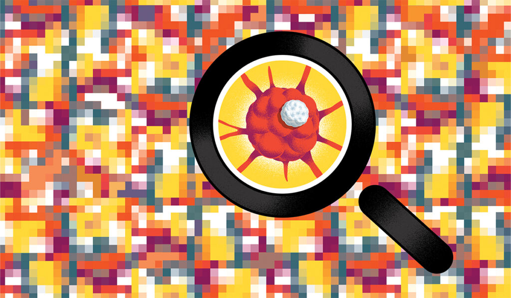 Illustration of a magnifying glass zooming in on a cancer cell in front of a multicolored array of pixels.