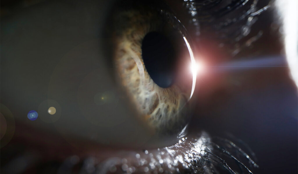 Close up of eye being examined