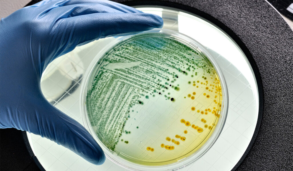 A scientist's gloved hand reaching for a petri dish of E. coli