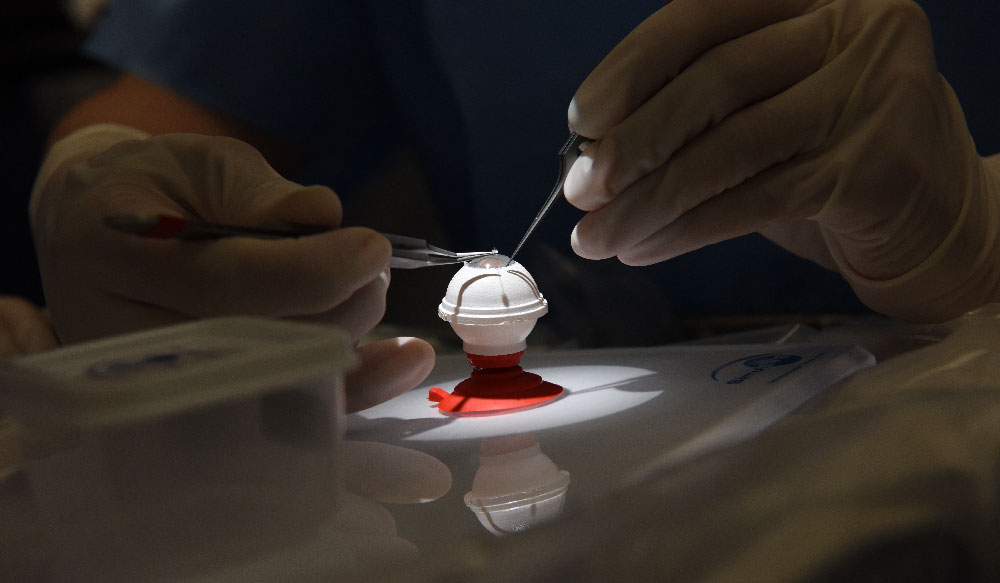 Physician manipulating model of human eye