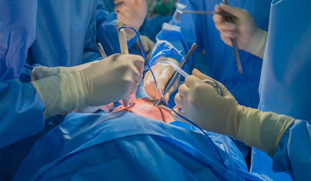 Doctors team wear blue coat perform heart surgery at the operating room in the hospital.