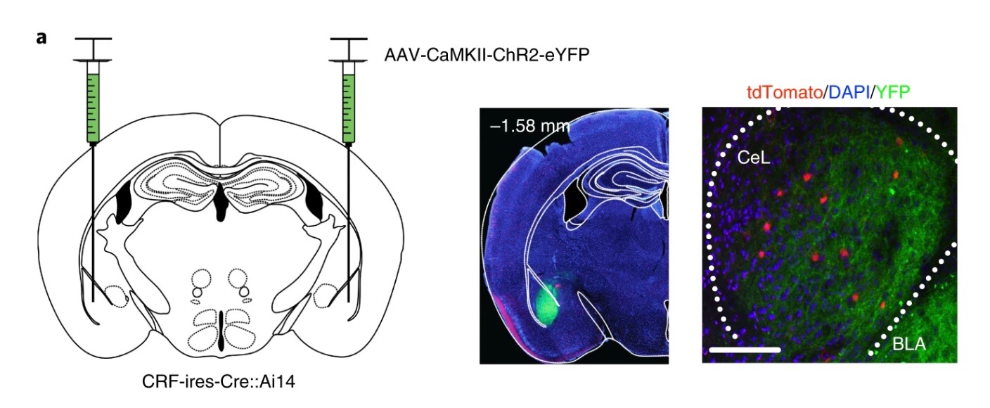 “Frozen” Fear Response May Underlie PTSD