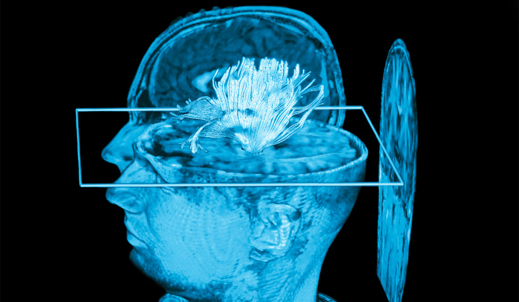 Using neuromodulation to conduct MRI of human brain.