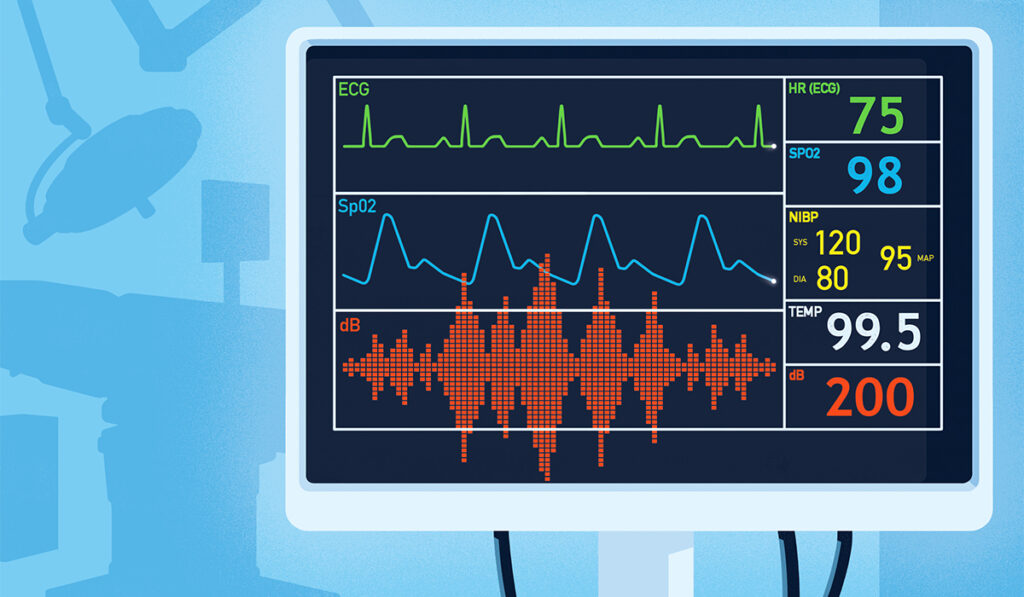 Illustration of loud ER