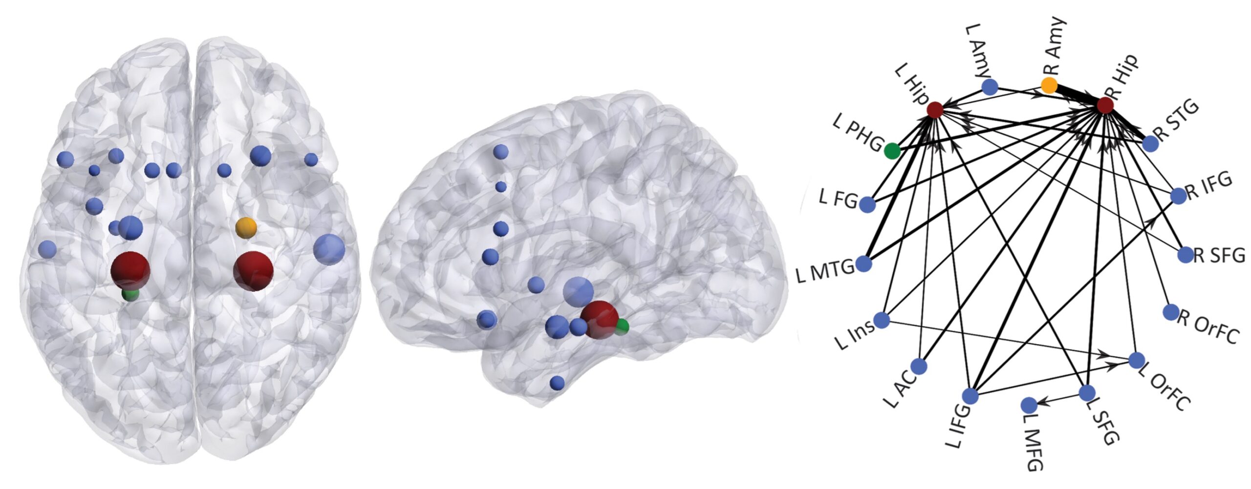 The Evolving Art of Epilepsy Surgery