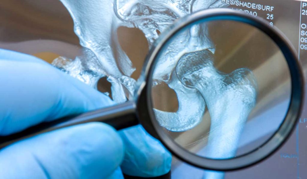 Scientist analyzing musculoskeletal infection in patient x-ray.