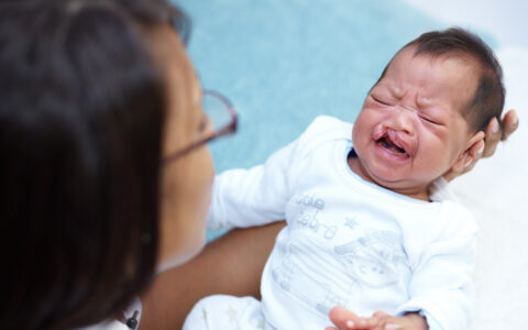 Baby with cleft palate and cleft lip