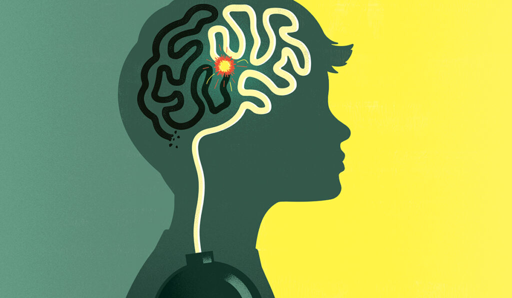 Illustration of brain with ticking time bomb