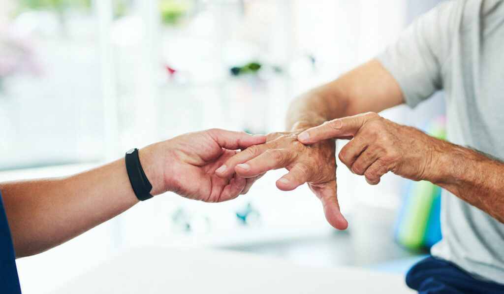 Showing arthritic hand