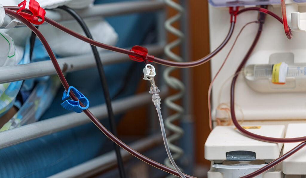 Dialysis machine close up