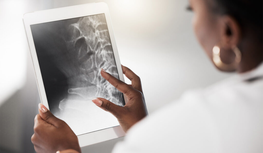 Doctor looking at bone scans