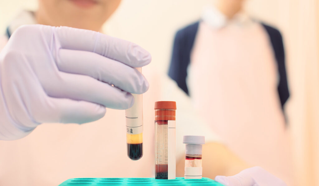 Lab equipment tubes in a lab