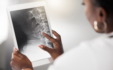 Doctor looking at bone scans